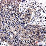 NME2 Recombinant Rabbit Monoclonal Antibody (K01_2N57)