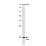 NME2 Antibody in Western Blot (WB)