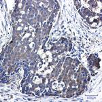 NME3 Recombinant Rabbit Monoclonal Antibody (K01_2N58)