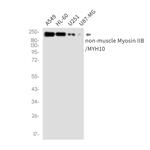 MYH10 Recombinant Rabbit Monoclonal Antibody (K01_2N60)
