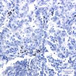 NR2F2 Antibody in Immunohistochemistry (Paraffin) (IHC (P))
