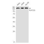 NUP155 Antibody in Western Blot (WB)