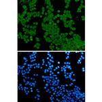 NUP50 Recombinant Rabbit Monoclonal Antibody (K01_2N68)