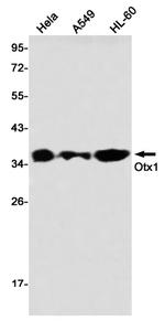 OTX1 Recombinant Rabbit Monoclonal Antibody (K01_2N73)