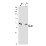P2Y13 Recombinant Rabbit Monoclonal Antibody (K01_2N77)