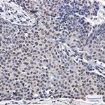 p57 Kip2 Antibody in Immunohistochemistry (Paraffin) (IHC (P))