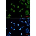 PEN2 Recombinant Rabbit Monoclonal Antibody (K01_2N85)