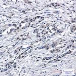 PEN2 Antibody in Immunohistochemistry (Paraffin) (IHC (P))
