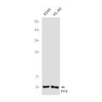 PF4 Antibody in Western Blot (WB)