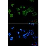 PLCG1 Recombinant Rabbit Monoclonal Antibody (K01_2N91)