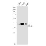 PIM2 Recombinant Rabbit Monoclonal Antibody (K01_2N93)