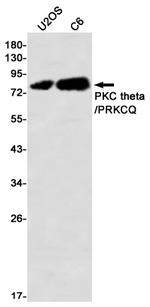PKC theta Recombinant Rabbit Monoclonal Antibody (K01_2N94)