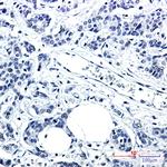 PNK Recombinant Rabbit Monoclonal Antibody (K01_2N97)