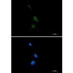 PREPL Recombinant Rabbit Monoclonal Antibody (K01_2P03)