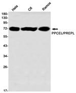 PREPL Antibody in Western Blot (WB)
