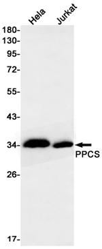 PPCS Recombinant Rabbit Monoclonal Antibody (K01_2P04)