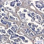 Caspase 7 Recombinant Rabbit Monoclonal Antibody (K01_2P07)