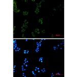 Prohibitin Recombinant Rabbit Monoclonal Antibody (K01_2P08)