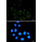 CUX1 Recombinant Rabbit Monoclonal Antibody (K01_2P09)