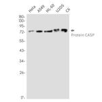 CUX1 Antibody in Western Blot (WB)