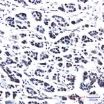 PRPF4 Recombinant Rabbit Monoclonal Antibody (K01_2P10)