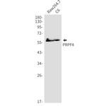 PRPF4 Antibody in Western Blot (WB)