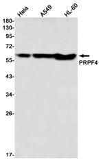 PRPF4 Antibody in Western Blot (WB)