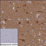 PYK2 Recombinant Rabbit Monoclonal Antibody (K01_2P15)