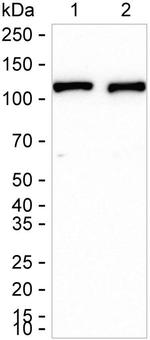 PYK2 Antibody in Western Blot (WB)
