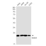RAB29 Recombinant Rabbit Monoclonal Antibody (K01_2P18)
