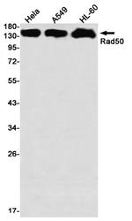 RAD50 Antibody in Western Blot (WB)