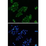 RAIDD Recombinant Rabbit Monoclonal Antibody (K01_2P22)