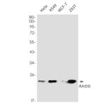 RAIDD Antibody in Western Blot (WB)