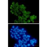 RANGAP1 Recombinant Rabbit Monoclonal Antibody (K01_2P23)