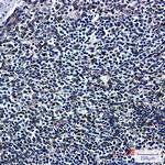 RANGAP1 Antibody in Immunohistochemistry (Paraffin) (IHC (P))