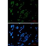 RAP80 Recombinant Rabbit Monoclonal Antibody (K01_2P24)