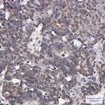 RAP80 Antibody in Immunohistochemistry (Paraffin) (IHC (P))