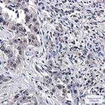 RASA1 Recombinant Rabbit Monoclonal Antibody (K01_2P26)