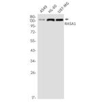 RASA1 Antibody in Western Blot (WB)