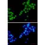 RBM3 Recombinant Rabbit Monoclonal Antibody (K01_2P27)
