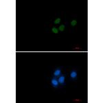 RCC1 Recombinant Rabbit Monoclonal Antibody (K01_2P28)