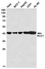 RCC1 Antibody in Western Blot (WB)