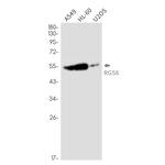 RGS6 Recombinant Rabbit Monoclonal Antibody (K01_2P29)