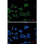 RhoGDI Antibody in Immunocytochemistry (ICC/IF)