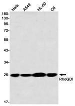 RhoGDI Antibody in Western Blot (WB)