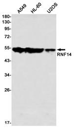 RNF14 Recombinant Rabbit Monoclonal Antibody (K01_2P31)