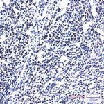 RPS20 Recombinant Rabbit Monoclonal Antibody (K01_2P34)