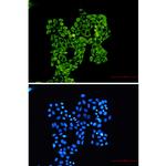 RPS8 Recombinant Rabbit Monoclonal Antibody (K01_2P35)