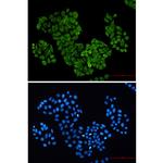 S100A6 Recombinant Rabbit Monoclonal Antibody (K01_2P37)