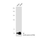 S100A6 Antibody in Western Blot (WB)